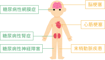 糖尿病 慢性の合併症